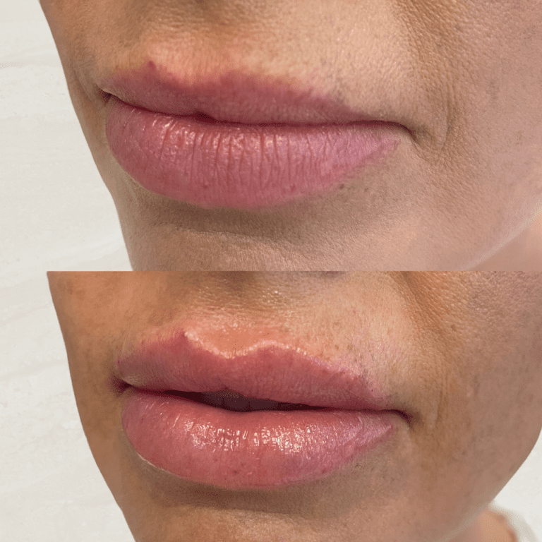 Gallery Lips 1 16 png