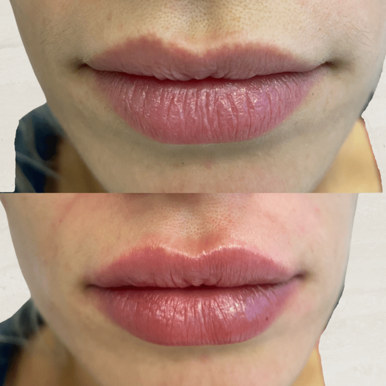 Gallery Lips 3 4 png