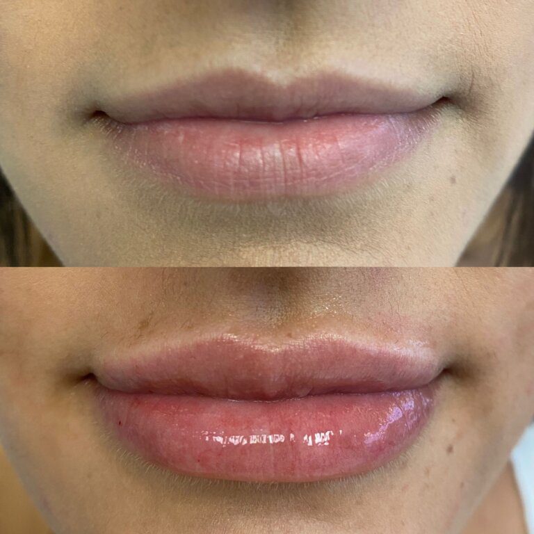 Gallery Lips lipsnofilter4